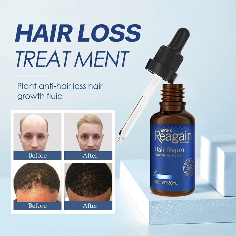 For Sale Hair-Repro Oil-Treatments Regain Beard-Care Men/women for And To Thick-Hair Nourish Anit Zn7mzGq1kG1