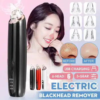

Face Acne Black Dot Pimple Blackhead Remover Electric Microcrystalline Blackhead Vacuum Cleaner Pore Blackhead Skin Care Machine
