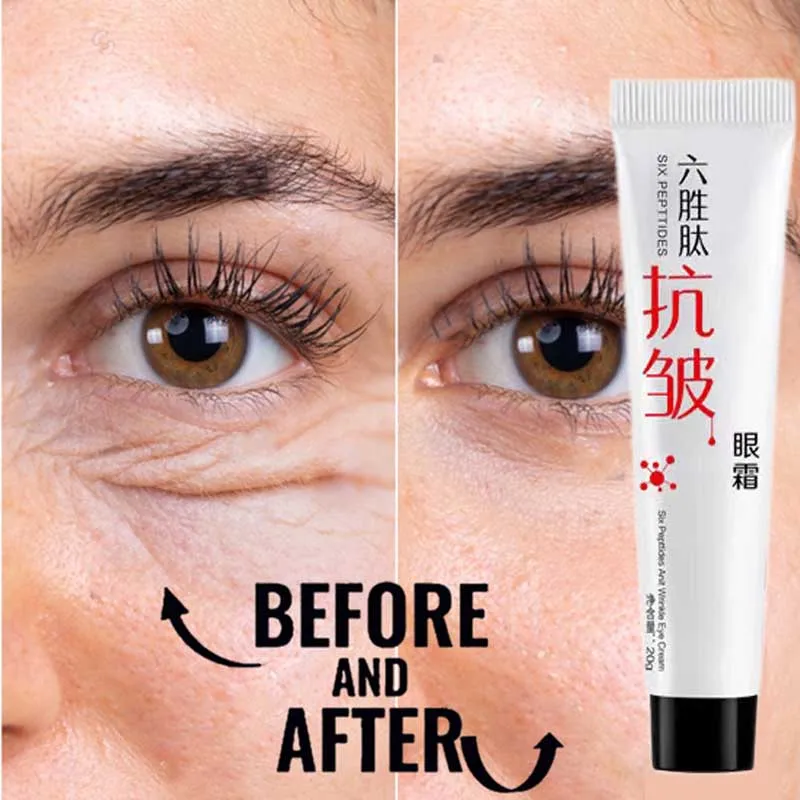Instant Remove Eye Bags Cream Anti Puffiness Gel Dark Circles Delays