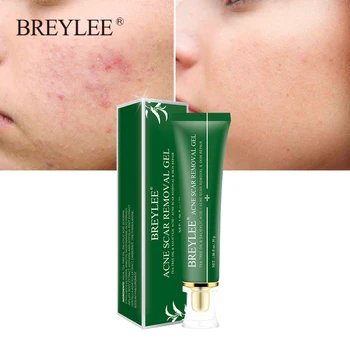 

BREYLEE Acne Scar Removal Gel Fade Acne Marks Spots Remove Skin Pigmentation Soothing Prevent Acne Treatment Serum Essence 30g