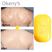 90 г Шанхай серное мыло от акне лечение масло против угрей-контроль удалитель мыло отбеливание моющее средство Китайский традиционный уход за кожей