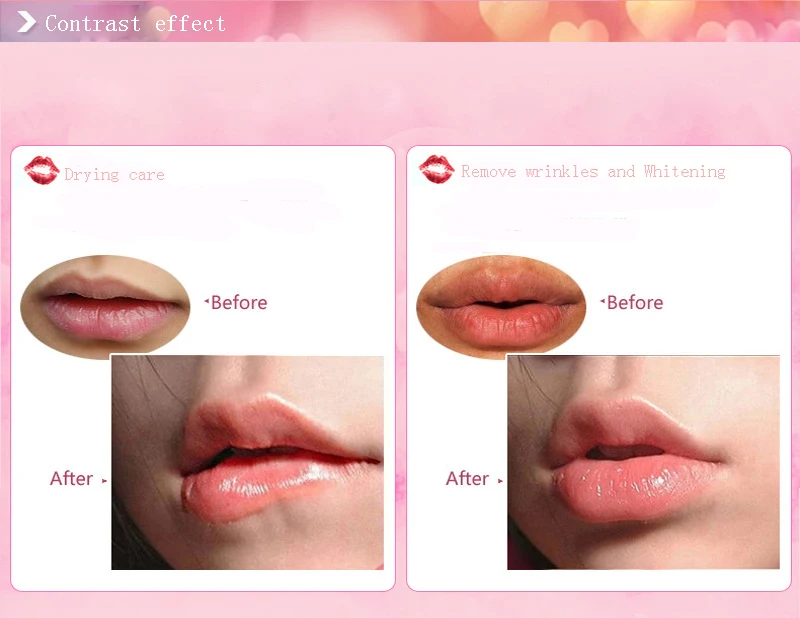 5/3/1 Pcs Collagen Lip Repairing Mask Pads Patch for Lip Moisturizing Exfoliating Anti Ageing Lips Pump Essentials Lips TSLM1