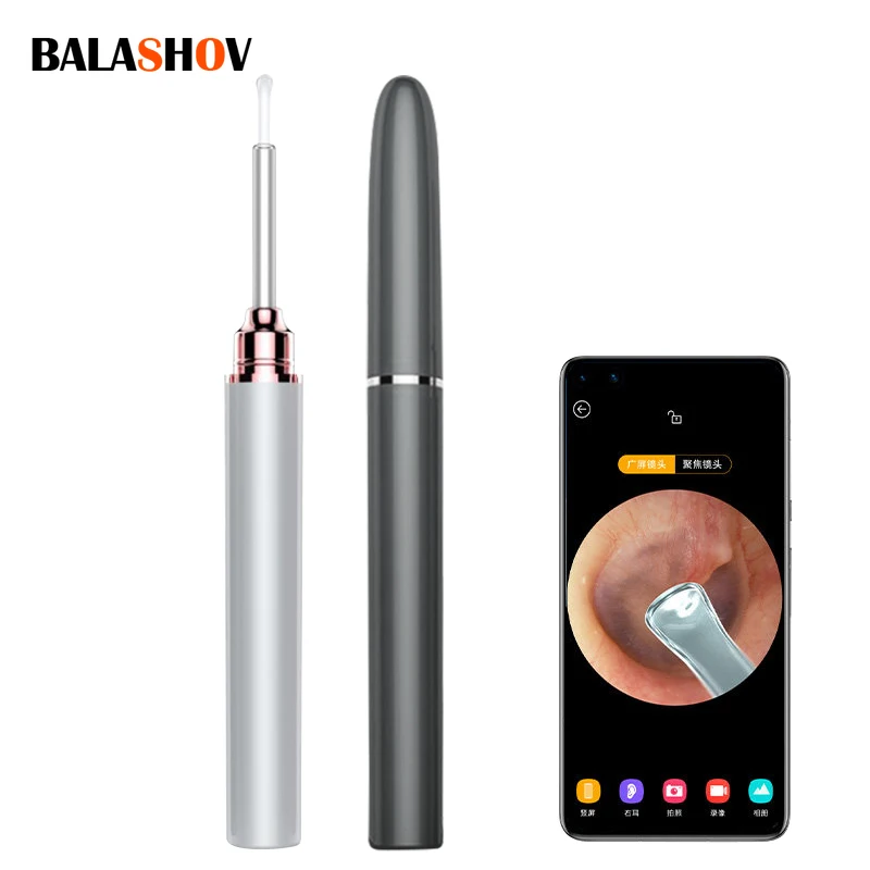 Cure-oreille visuel Intelligent, 500W, sans fil, haute précision,  Endoscope, Mini caméra, Otoscope, boroscope, nettoyeur d'oreille USB -  AliExpress