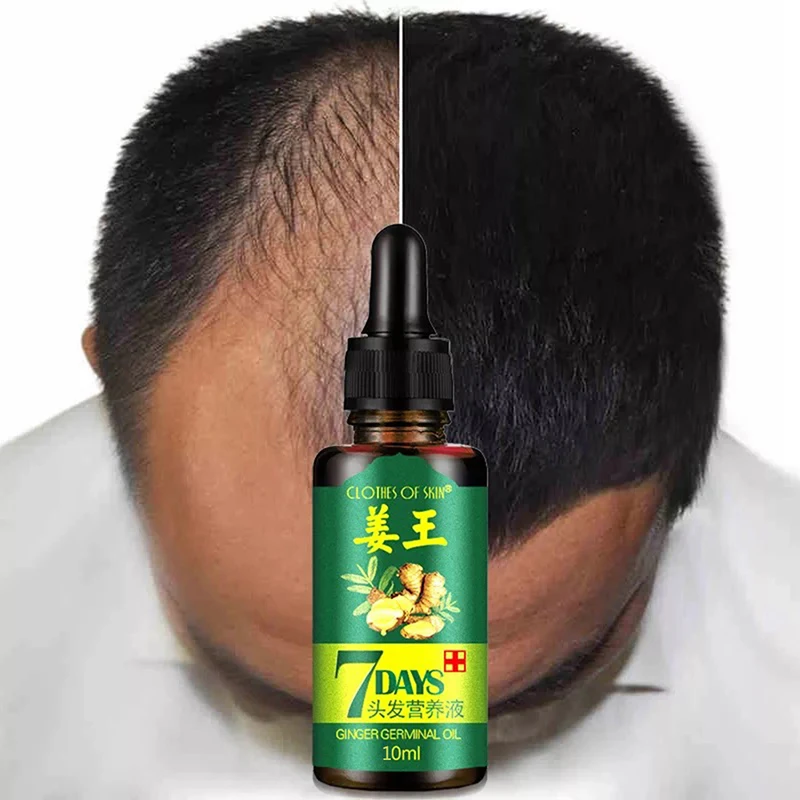 Новая маленькая 10 мл 7 дней Имбирная эссенция Парикмахерская маска для волос эфирное масло для ухода за волосами масло сухое и поврежденное питание для волос
