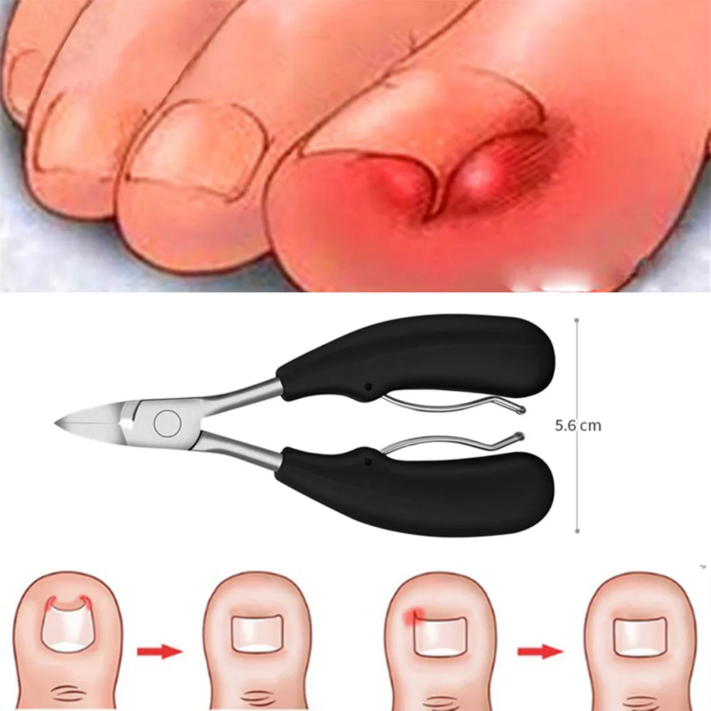 

New Toe Nail Clippers 1PC Nail Correction Nippers Clipper Cutters Dead Skin Dirt Remover Podiatry Pedicure Care Tool