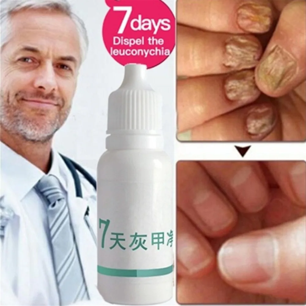 12 мл натуральный травяной уход за ногтями Бережный уход за кожей ...