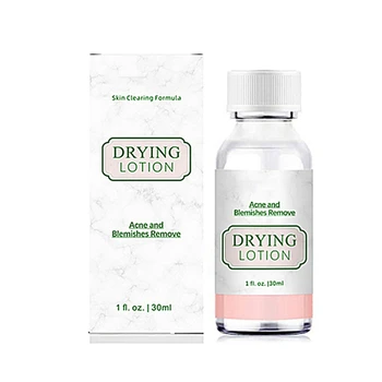 

30ml effective acne treatment dry lotion anti-acne acne pimples blemishes