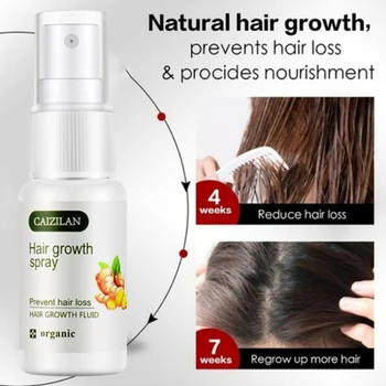 

Ginger Hair Growth Spray Essential Oil Hair Loss Liquid Hair Growth Spray For Men Women Hair Care 20ML