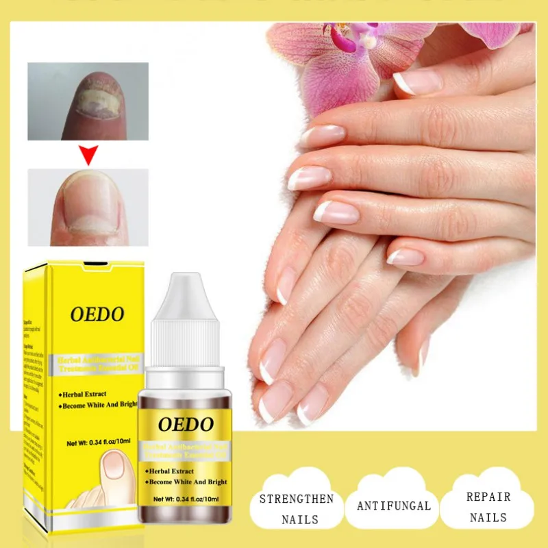 Herbal Antibacterial Nail Treatment Essential Oil Anti Fungus Nourishing Moisturizing Cuticle Nail Oil