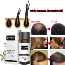 Suero de aceite esencial para el crecimiento del cabello, pérdida de cabello productos Anti, tratamiento de reparación de crecimiento rápido, cuidado del cabello seco, rizado y dañado, 20ML