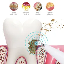 CkeyiN отбеливание зубов звуковая вибрация калькулятор зубной налет удалитель пятен уход за зубами гигиена полости рта с зеркалом