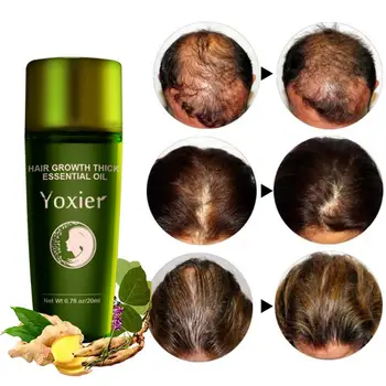 

Herbal Hair Growth Essential Oil Shampoo Hair Care Styling Hair Loss Product Thick Fast Repair Growing Treatment Liquid Hot Sale