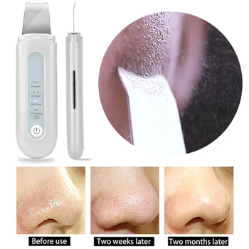 

Ultrasonic Skin Scrubber EMS Face Massager Remove Blackhead Wrinkle Pore Clean Face Cleanser Machine Skin Peeling Shovel Device