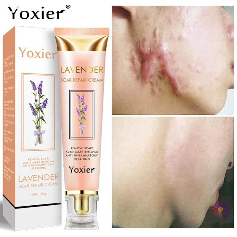 Yoxier Lavender Scar Repair Cream Acne Scar Removal Pigmentation