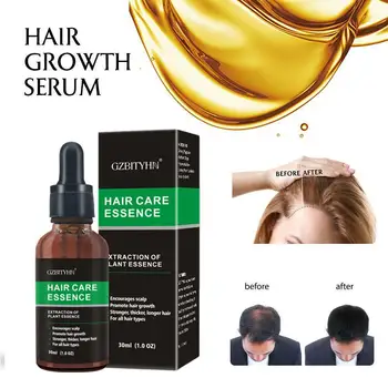 

30ml Hair Revitalizing Serum Ginger Fast Growth Essential Hair Anti Essence Preventing Plant Hair Oil Growth Care Fast Q8X7