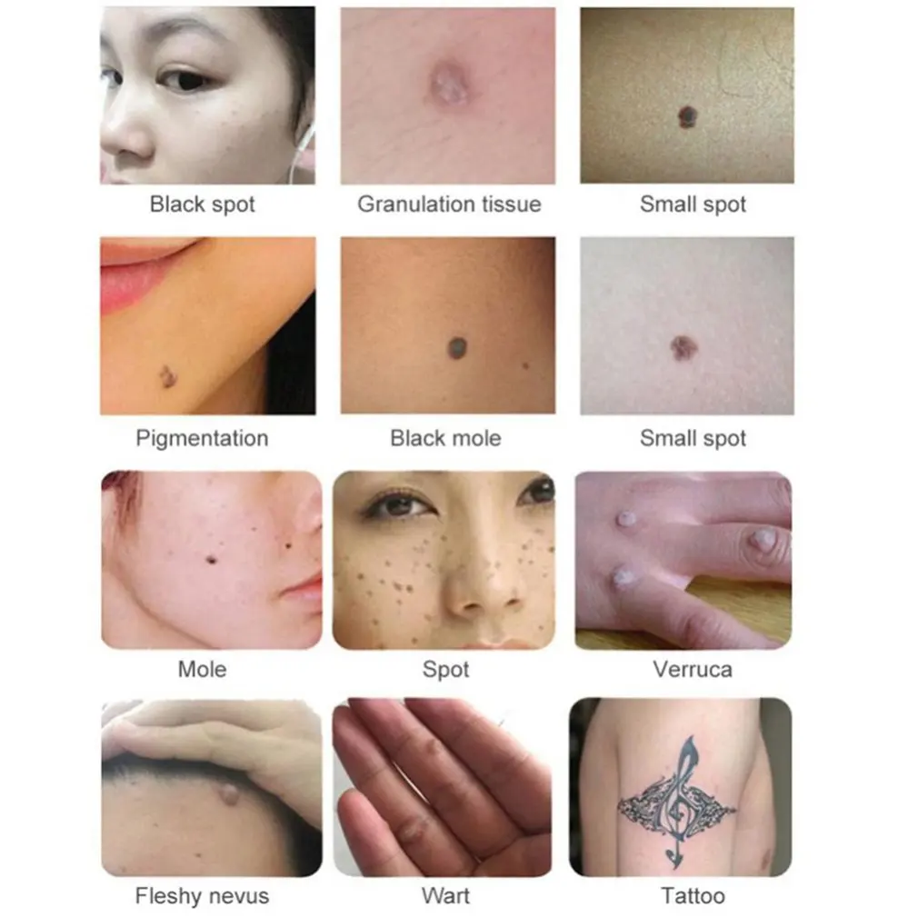  Professional Beauty Device Laser Freckle Dot Mole Tattoo Removal Sweep Spot Pen Anti-Aging Skin Car