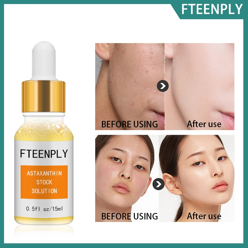 Fteenply Astaxanthin Serum Facial Whitening Moisturizing Hyaluronic