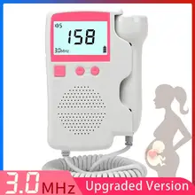 fetal doppler asda