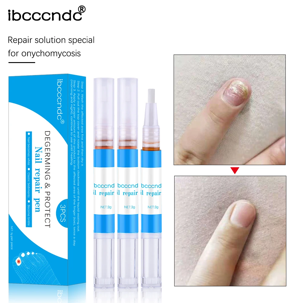 

3ml Nail Repair Pen for Onychomycosis Paronychia Anti Fungal Nail Infection Nails Care Treatment Health