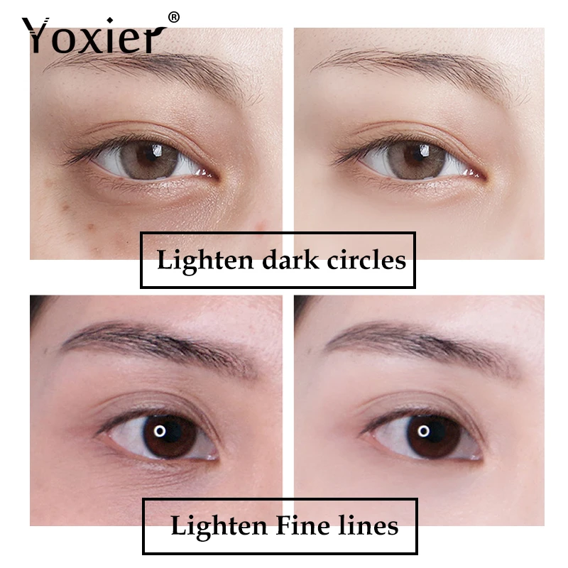 Yoxier Snail Firming Eye Serum Eye Cream Anti Aging Anti Puffiness Fine Lines Dark Circle Moisturizing 1 Yoxier Snail Firming Eye Serum Eye Cream Anti Aging Anti Puffiness Fine Lines Dark Circle Moisturizing 3