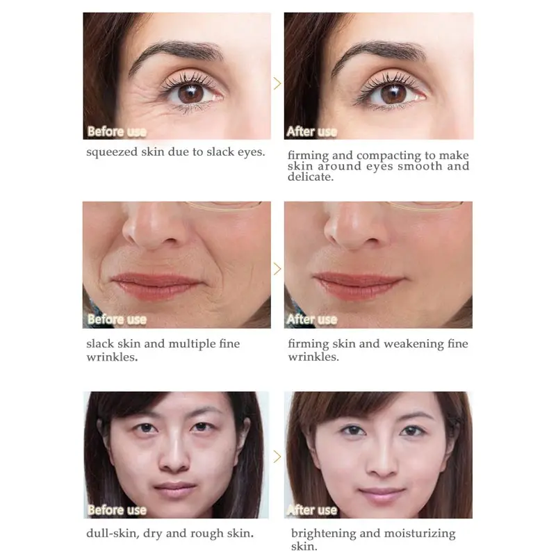 ARTISCARE Peptide Anti Wrinkle Facial Cream + Golden Eye Cream Anti-Aging Skin Care Whitening and Lifting Day