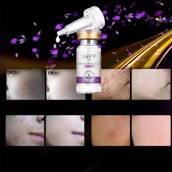 

QYANF 10ml Lavender Face Cure Acne Anti Face Repair Care Cream Anti Winkles Moisturizing Pigmentation Corrector Face Oil Cream