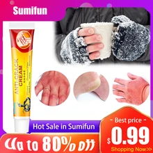 20g sumifun chilblain creme rachado mãos pés hidratante pomada para o inverno rachado pé calcanhar cuidados com a pele medicina ervas china