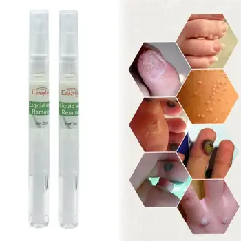 

Foot Corn Wart Removal Wart Treatment Wart Skin Tag Foot Corn Remover 3ml Neck Foot Finger Wart Tag Removal Skin Tools