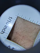 Lupa con mango de dermatoscopio 10X, visión clara suave con escala de medida, 30X, tipo B, visión más grande con luz UV