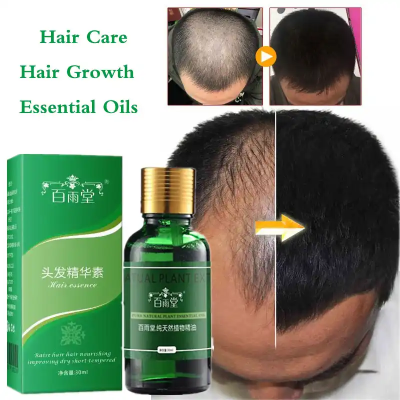 Hair Growth Essential Oils Essence Anti Hair Loss Products Health Care Beauty Faster Grow Dense Hair Care Liquid Serum Hair Growth Essential Oils Essence Anti Hair Loss Products Health Care Beauty Faster Grow Dense Hair Care Liquid Serum