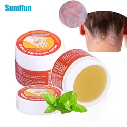 Sumifun Psoriasis Cream Dermatitis Eczematoid Eczema Ointment Antibacterial Anti itching Rash Urticaria Medical Plaste Skin Care