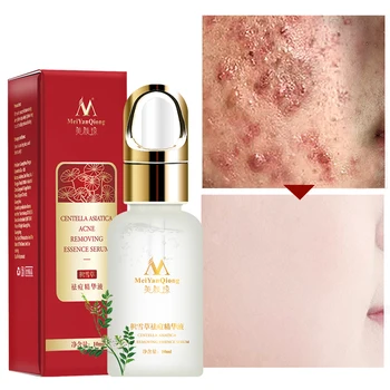 

10ml Anti-wrinkles Skin Repair Moisturizing Serum Natural Ingredient Oil Control Acne Essence Scar Removal Shrink Pores