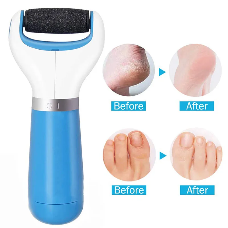 

Portable Electric Waterproof Foot Grinder Heel File Pedicure Machine Feet Hard Dead Skin Remover Foot file Care Tool