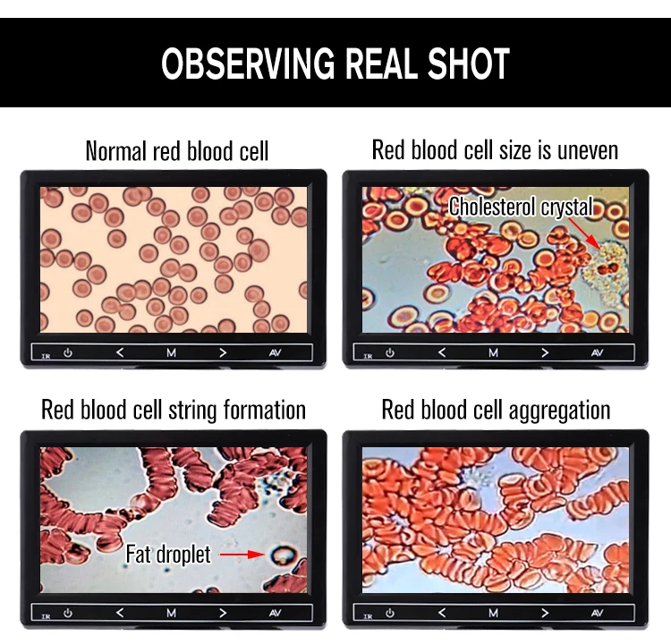 9英寸三目一滴血_04