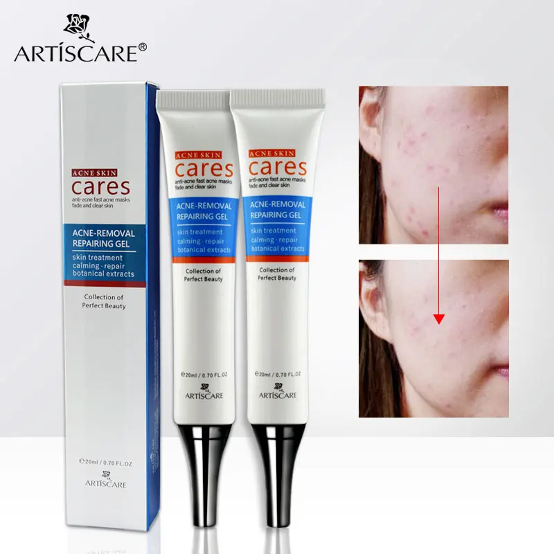 Artiscare Acne Treatment Gel Acne Cleaning Cream Blackhead Remover Acne