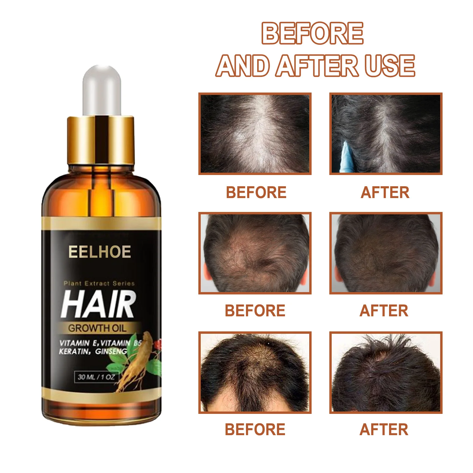 Hair Growth Serum Essential Oil Anti Hair Loss Spray Products Ginger Treatment Dry Frizzy Damaged Thin Hair Nourish Beauty Care