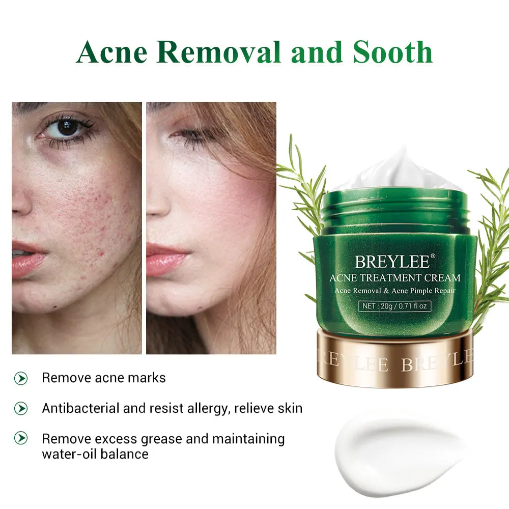 AcnePimple Patch Acne Treatment Serum Acne Cream Pimple Remover Tool Skin Care Face Cream Facial Serum Essence Face Mask