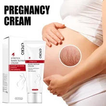 Stretch Marks Repair Cream Obesity Pregnancy Body Marks Acne Scars Removal Cream for Soft Tender Skin Body Care