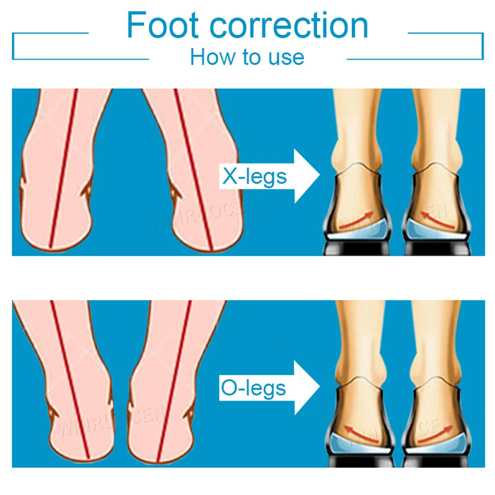 XO коррекция половина стельки унисекс Уход за ногами Plantar Fasciitis Achilles Tendonitis каблук высокий Spur Pad облегчение боли гранулы массаж