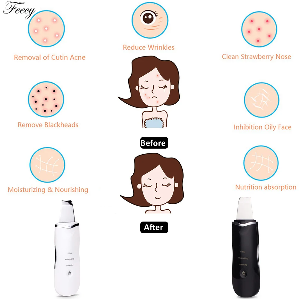 Ultrasonic Deep Face Cleaning Machine Skin Scrubber Peeling Blackhead Remover Pore Cleaner Exfoliator Facial Care Lifting Tools