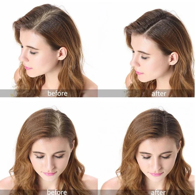 PURC gingembre produits de croissance des cheveux à croissance rapide Spray traitement du cuir chevelu huile beauté soins capillaires pour hommes femmes 30ml