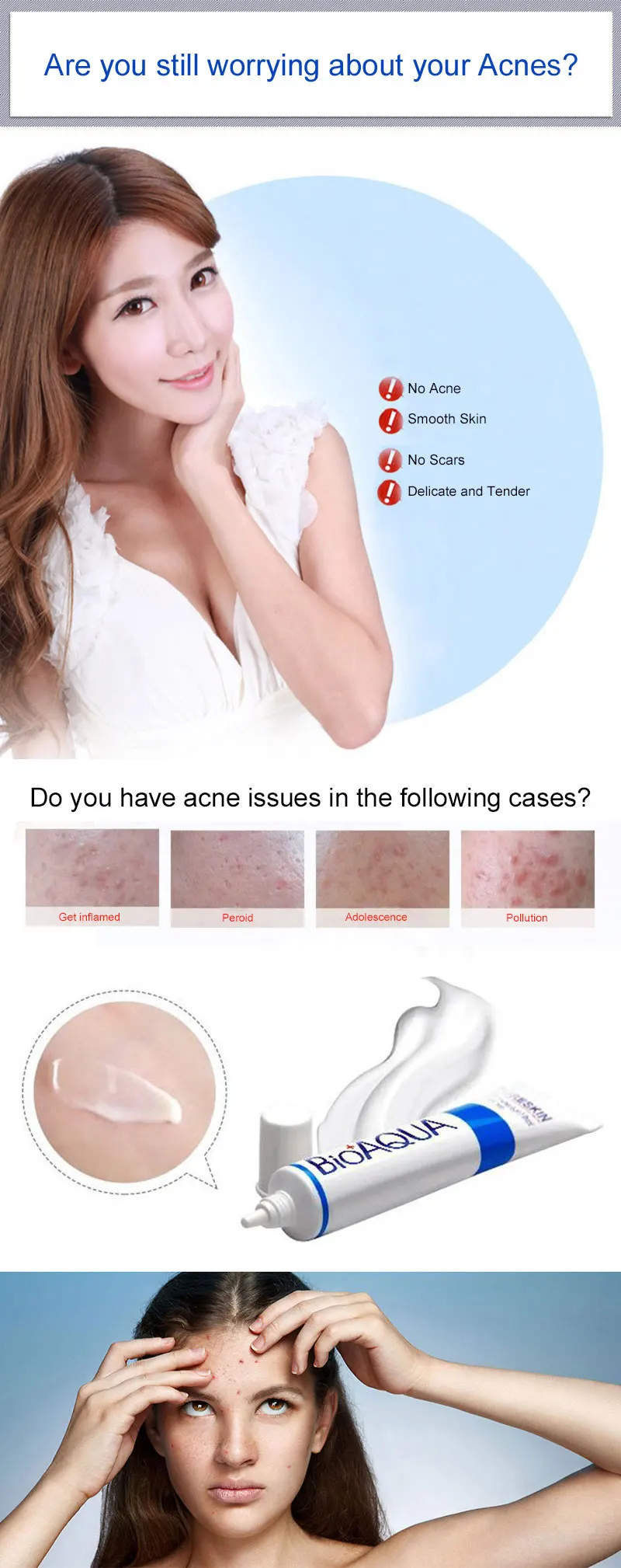 Acne Removal Cream Gel AntiAcne Scar Treatment Skin Care By BIOAQUA