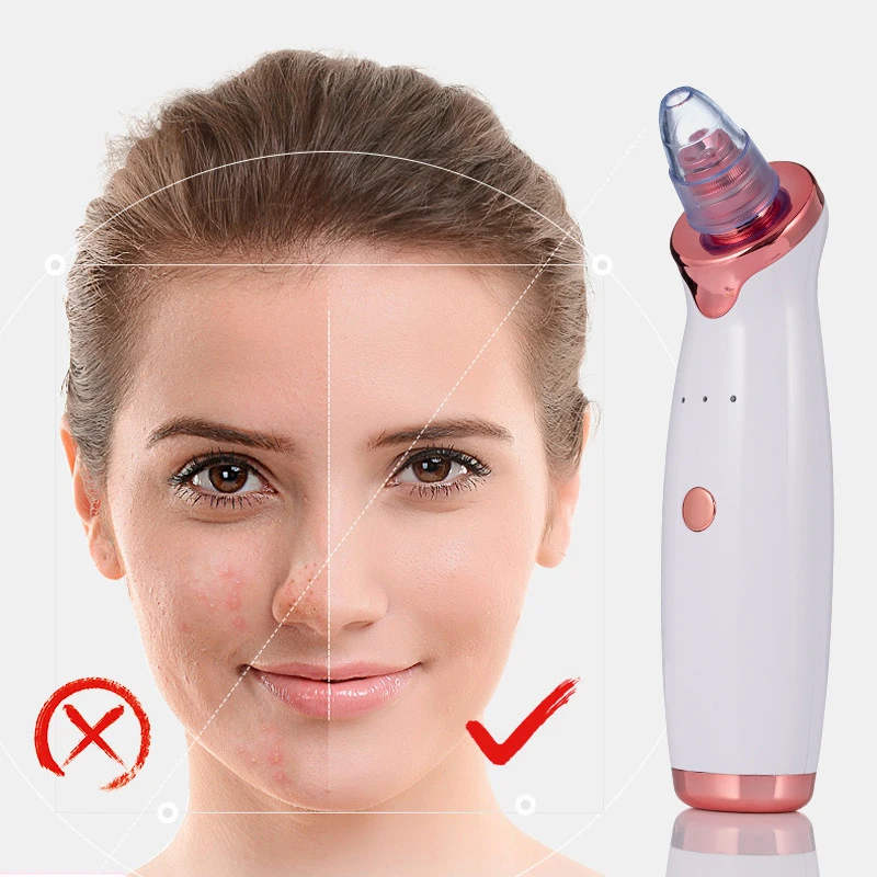 Electric-Acne-Remover-Point-Noir-Blackhead-Vacuum-Extractor-Tool-Black-Spots-Pore-Cleaner-Skin-Care-Facial (1)