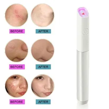 

Wholesale Red Blu-ray Acne Laser Pen phototherapy acne Advice Soft Scar Remove Light Therapy Pen