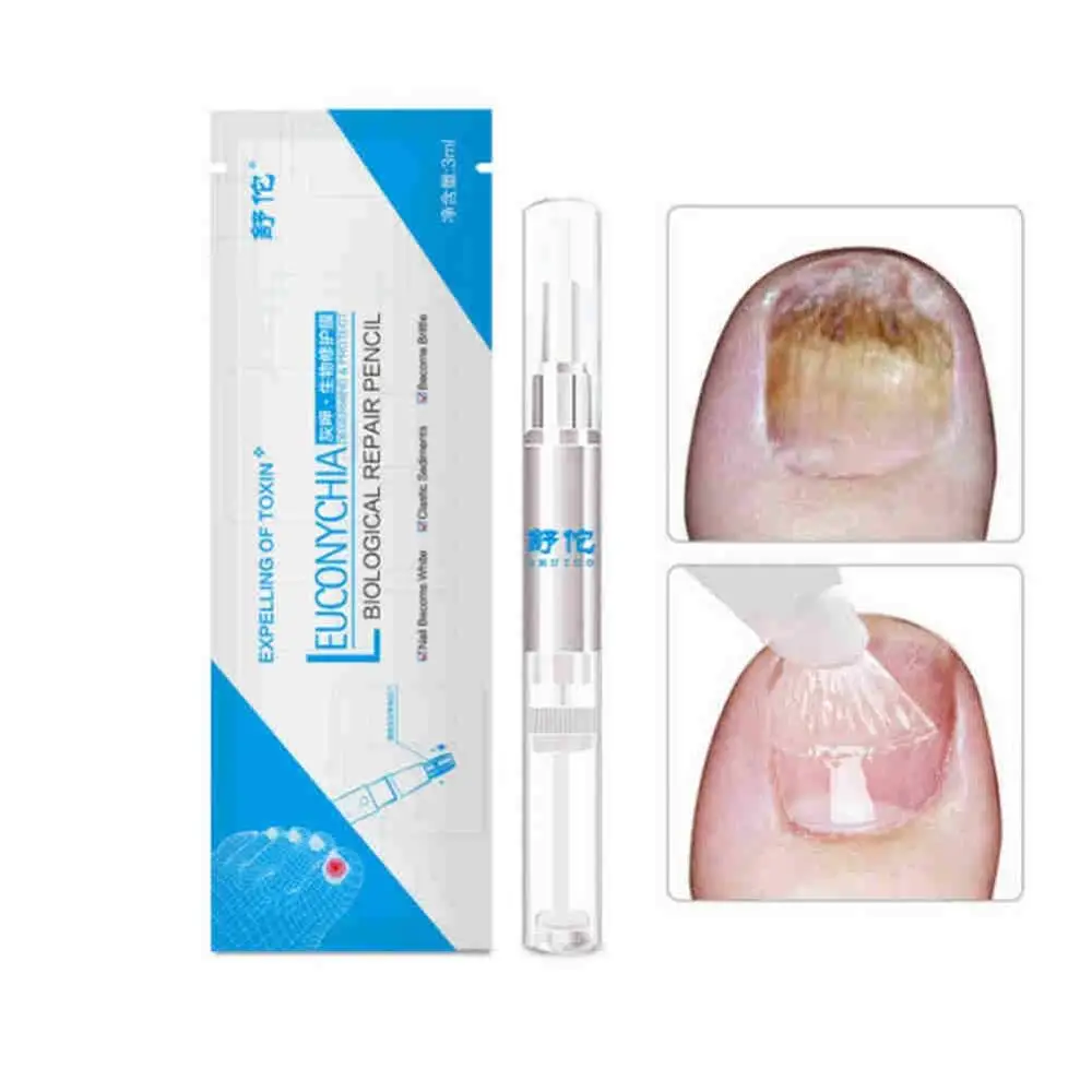 

Nail Care Solution Repair Nails Inhibition of Fungal Infections Toenail Fungus Treatment Product