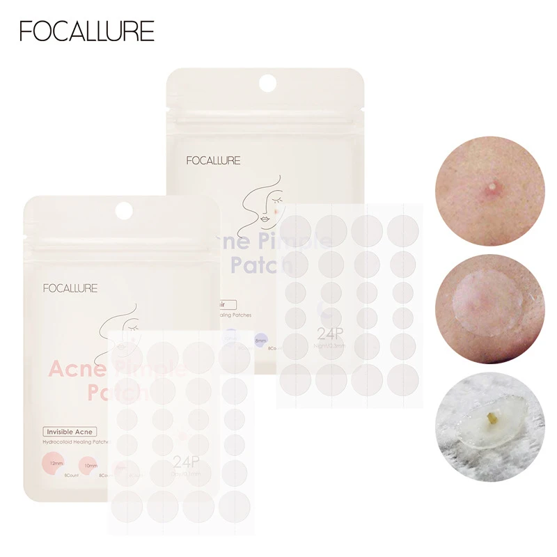 Parche para espinillas de día y noche, removedor de acné, pegatina de árbol de té, máscara de extracto, cuidado de la piel, 24 parches, elimina con eficacia, parche para acné, TSLM2