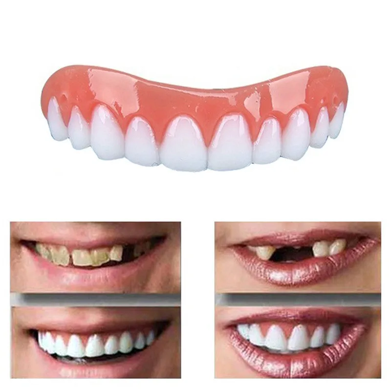 Идеальная улыбка виниры коррекция зубов Ложные протезы Bad зубы виниры отбеливание зубов
