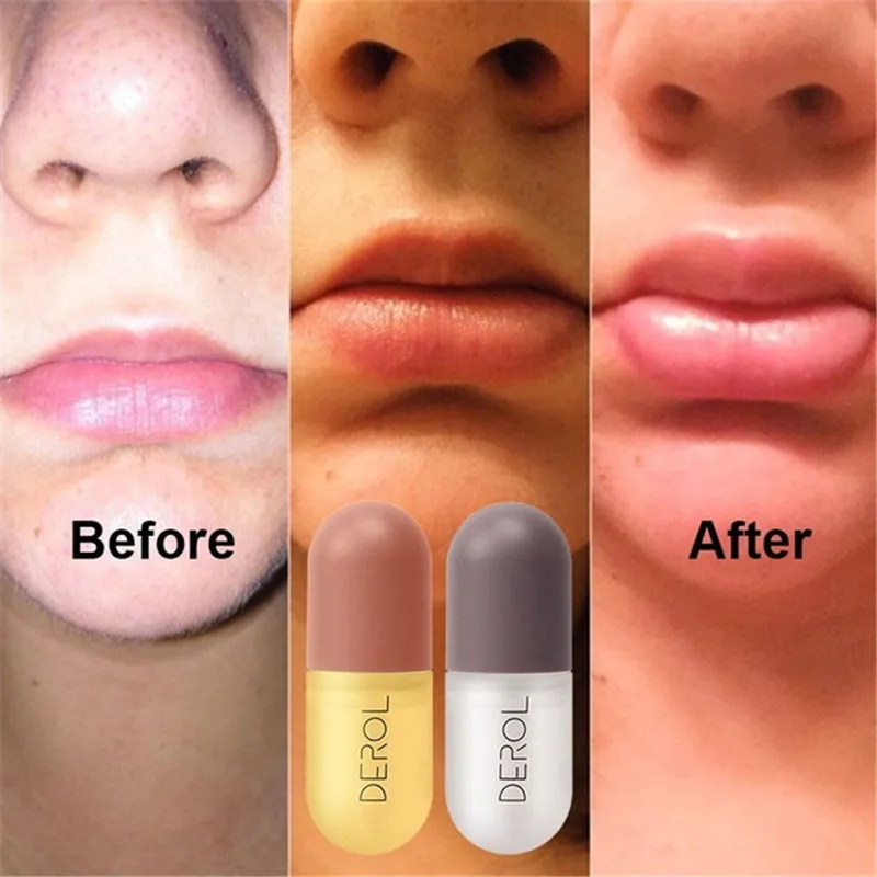 5e81dd1a65fdf9fb41ecde16-5-large