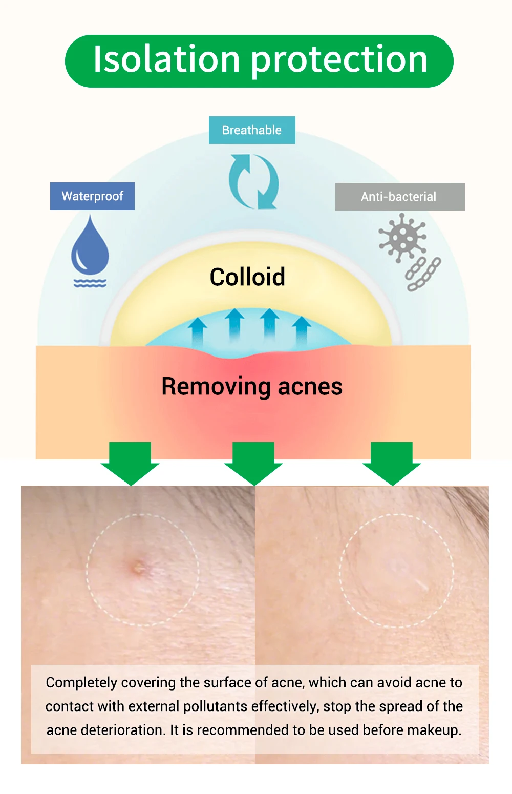 贝利祛痘贴(夜用)_05