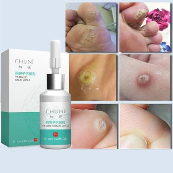 

Mole & Skin Tag Repair Solution Painless Mole Skin Dark Spot Repair Face Wart Tag Freckle Repair Cream Oil Dropshipping D243